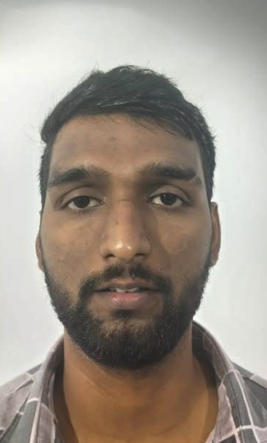 Melasma & Stubborn Pigmentation Clearance - Before