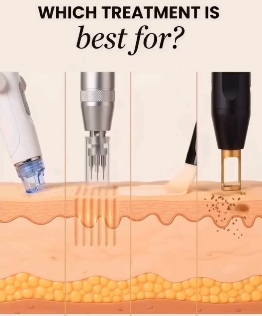 Skin Treatment types