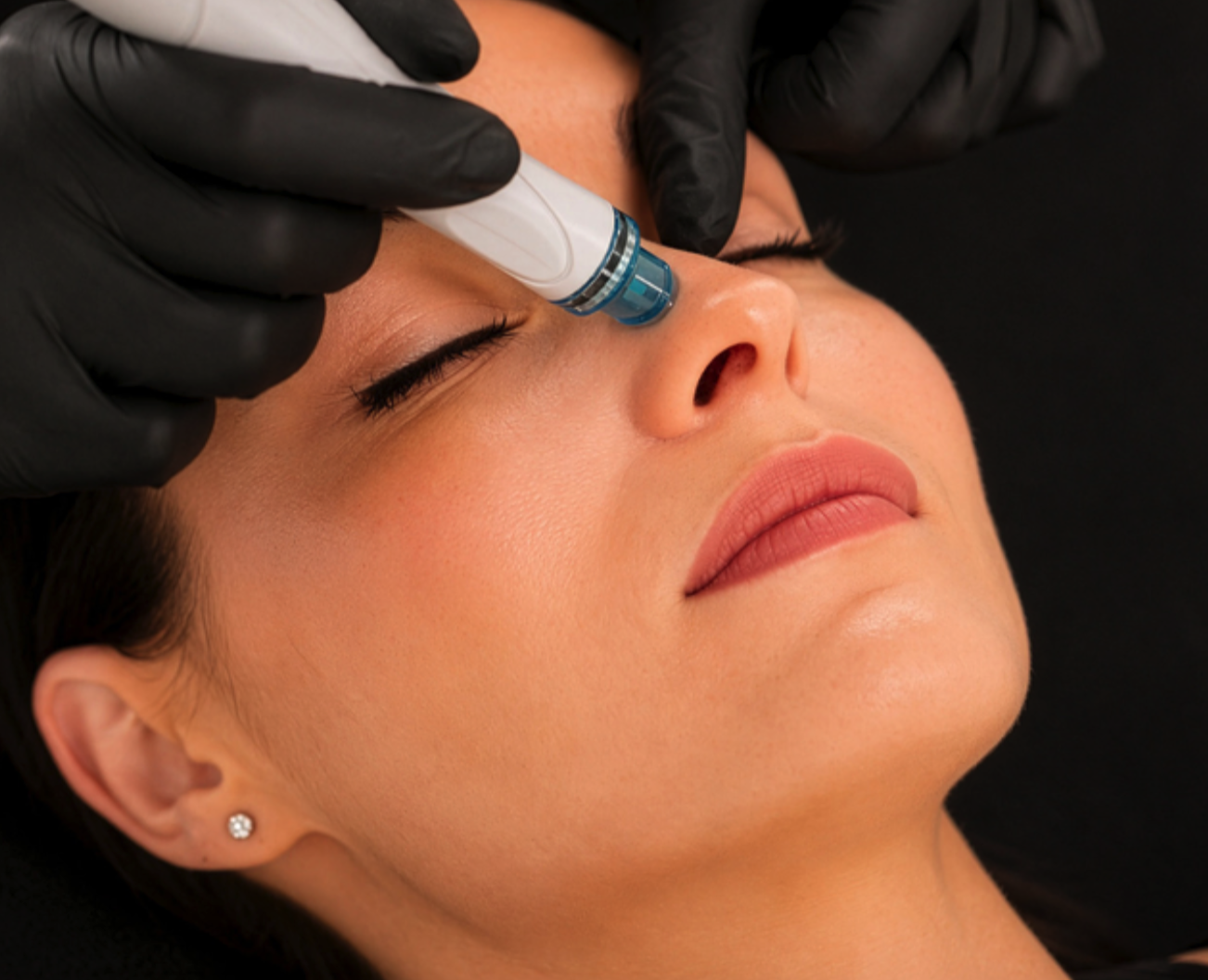 HydraFacial MD & Deep Pore Cleansing