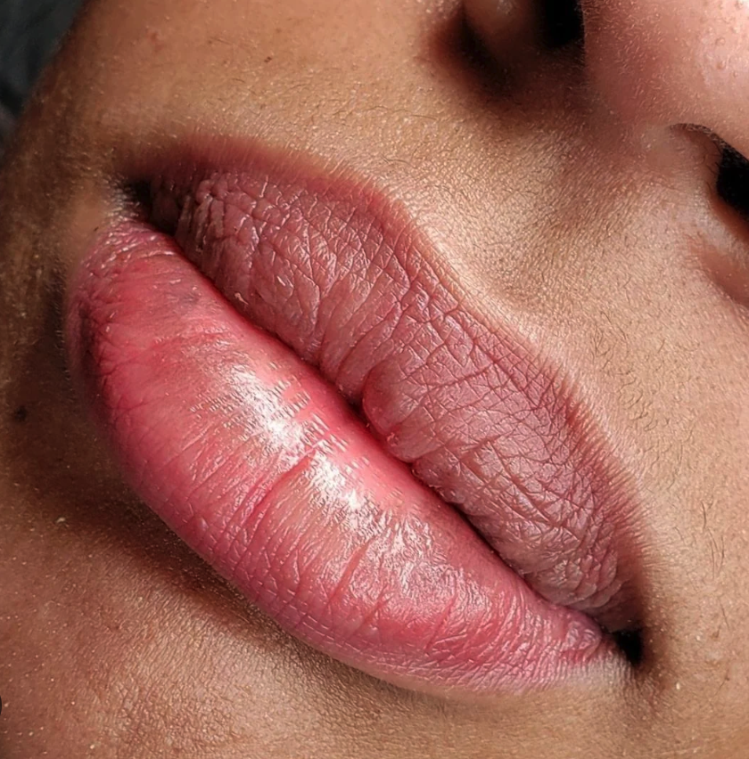 Lip Neutralization & Blush Pigmentation
