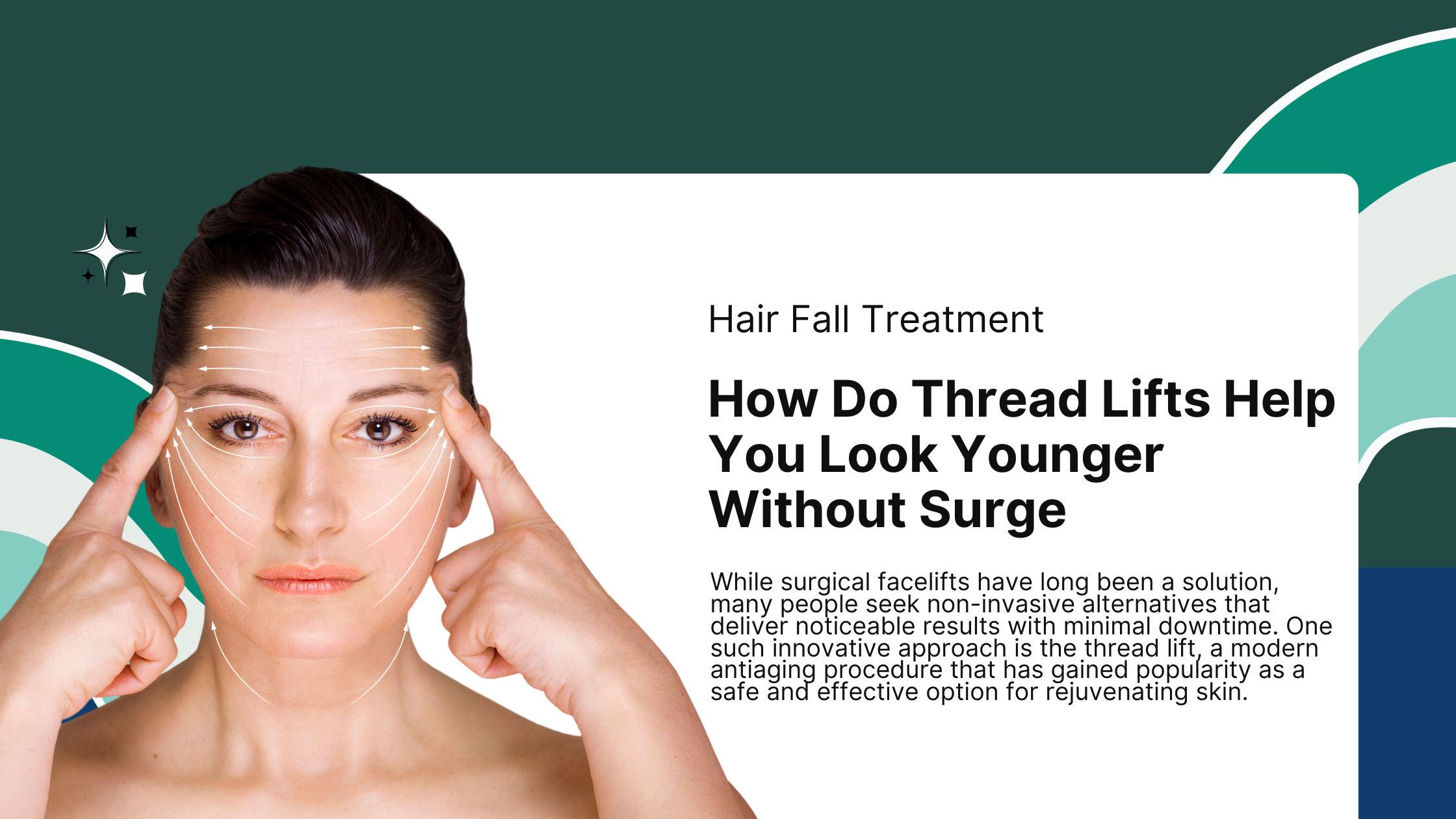 How Do Thread Lifts Help You Look Younger Without Surgery?